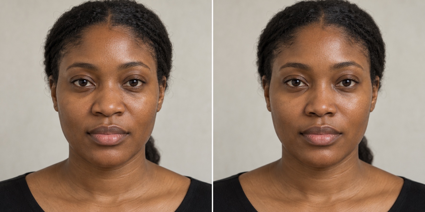 AI-generated concept showing the same fictional African woman before and after an imagined subtle nose refinement. A subtle refinement, seen from the front.
